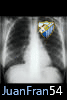 Avatar de JuanFran54